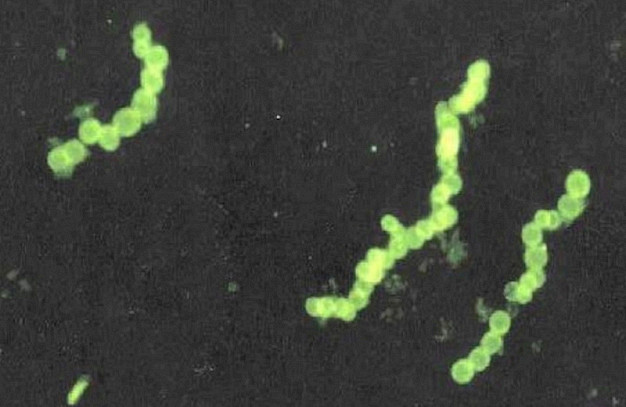 Main image for page: Svavelätande bakterier - 1,8 miljarder år gamla - men samma som idag